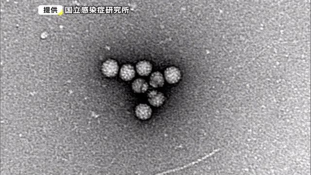 ノロウイルスによる食中毒が増加　岡山県に食中毒注意報【岡山】