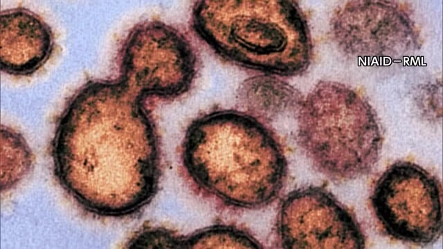 新型コロナウイルス　岡山県で５人が感染　県内の感染者はこれで２６４１人　【岡山】