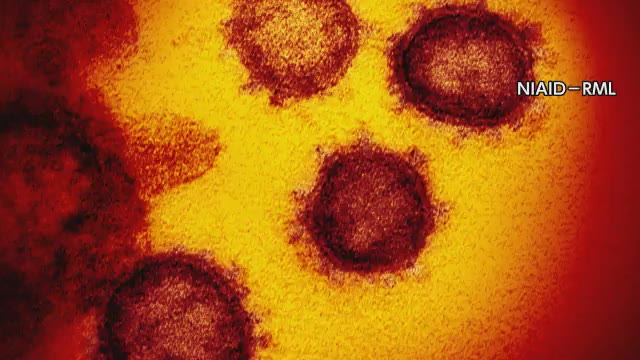 【感染状況】香川県で１１人が感染　４月の感染者約８割が変異ウイルスの疑いと発表【香川】