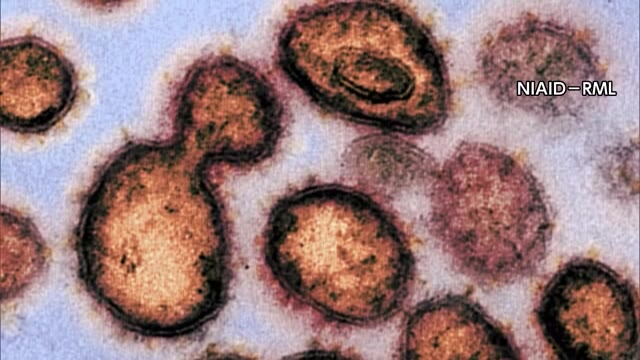 新型コロナウイルス　新たに岡山県で9人香川県で10人感染【岡山・香川】