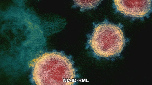 【感染状況】香川県で１人が感染　患者１人が死亡【香川】
