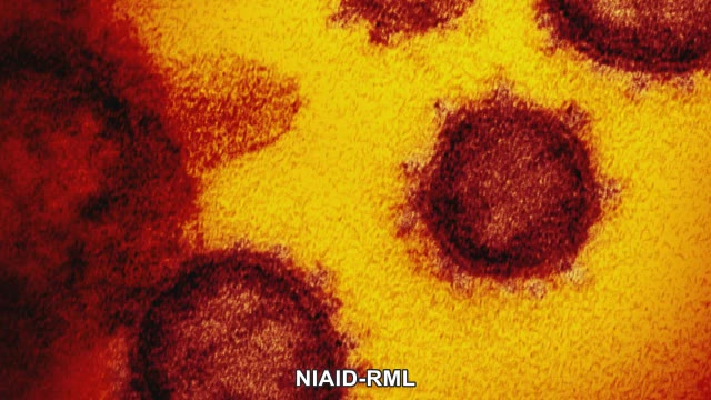 【感染詳報】前の週と同じ曜日を約１ヵ月ぶりに上回る　岡山県で新たに１０７９人が感染　１人死亡【岡山】