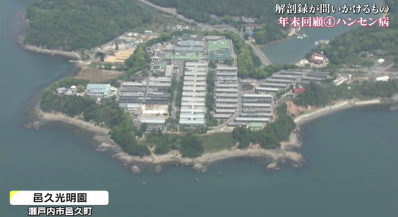 解剖　　５
